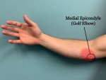 elbow-injury-2.jpg