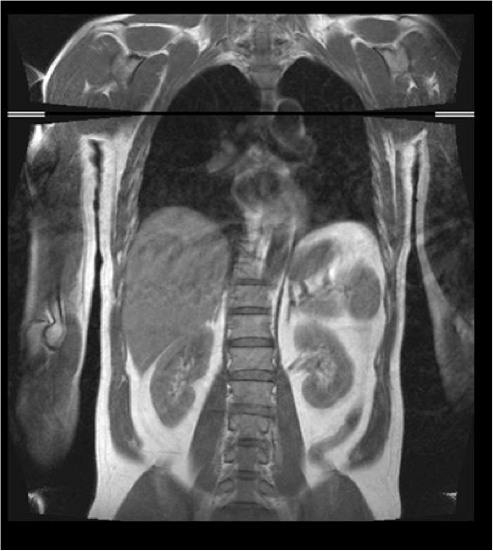 thebloodsugardiet.com