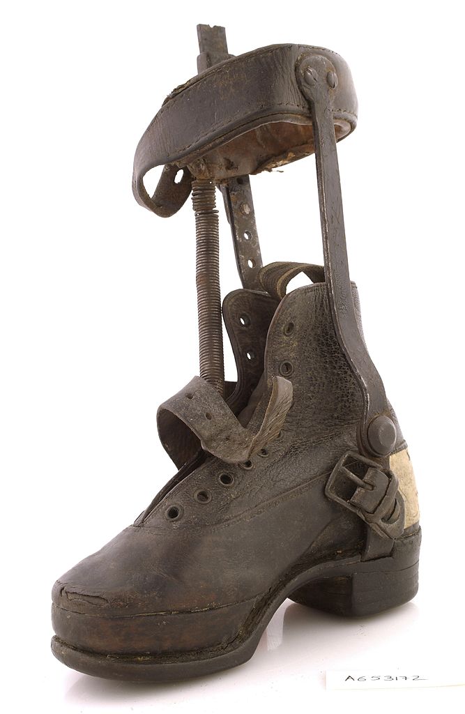 667px-A_Victorian_child's_shoe_and_leg_caliper_Wellcome_L0035621.jpg